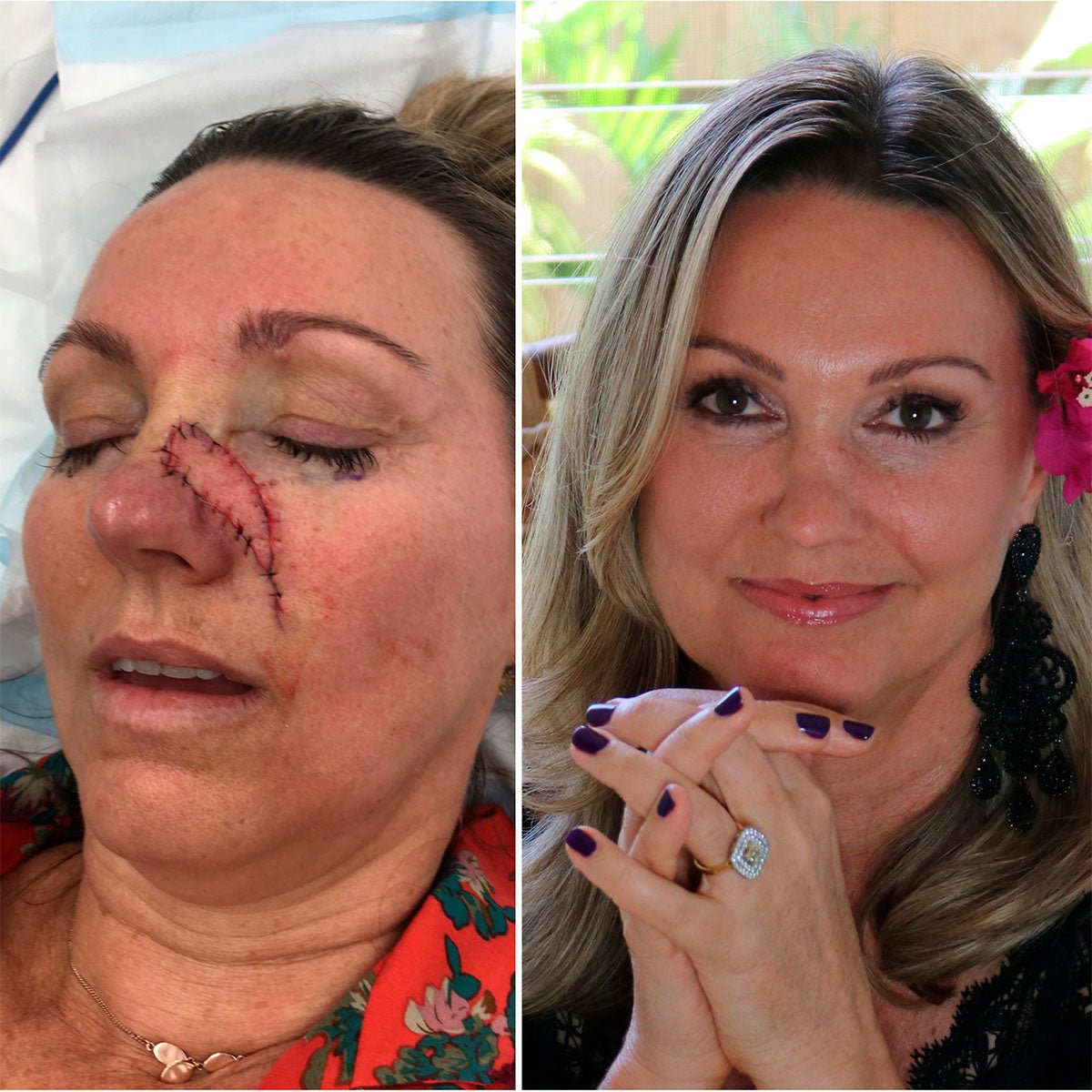 Removing the reminder - Eco By Sonya Australia