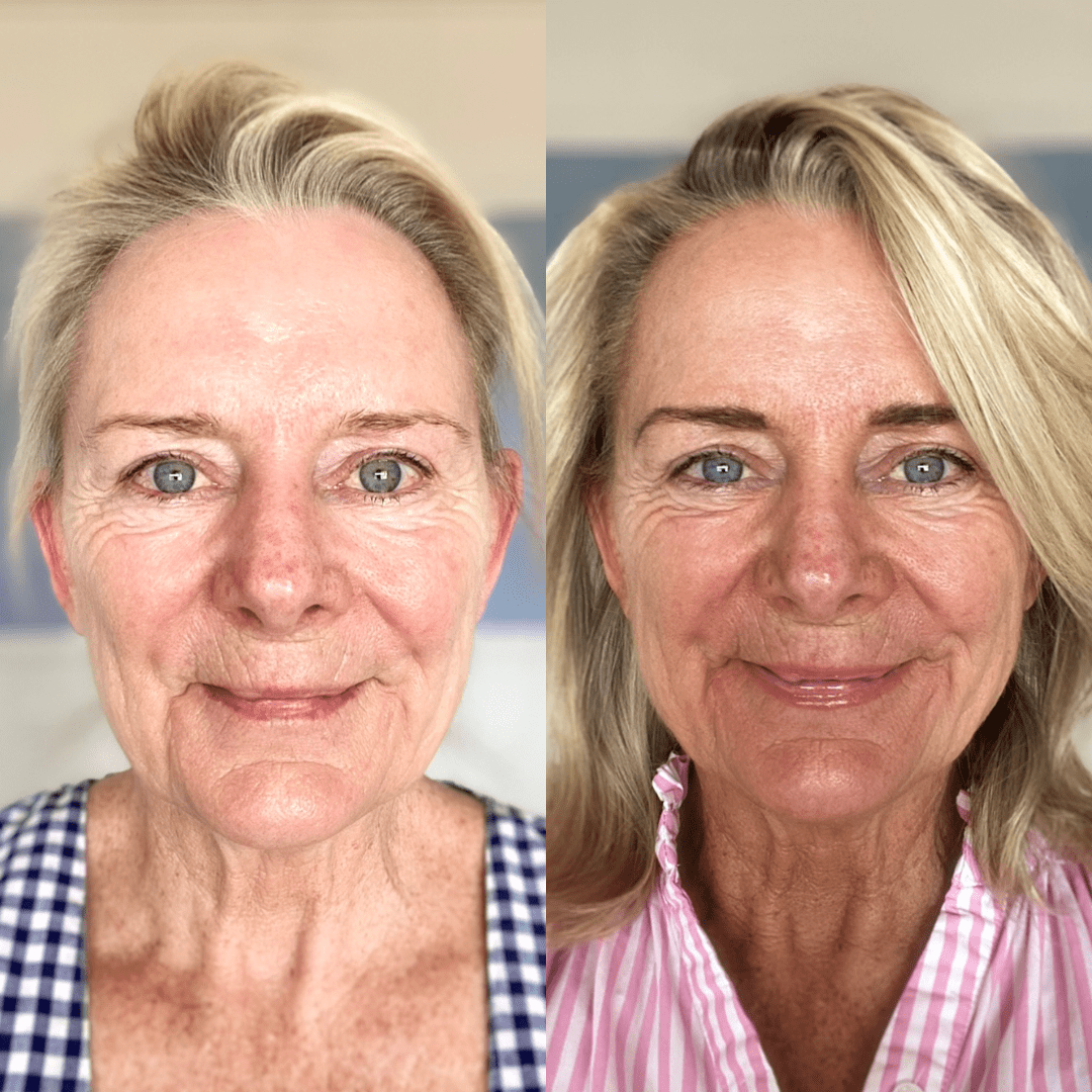 Face Tan Water - Eco Tan before after results sunless tan on mature skin