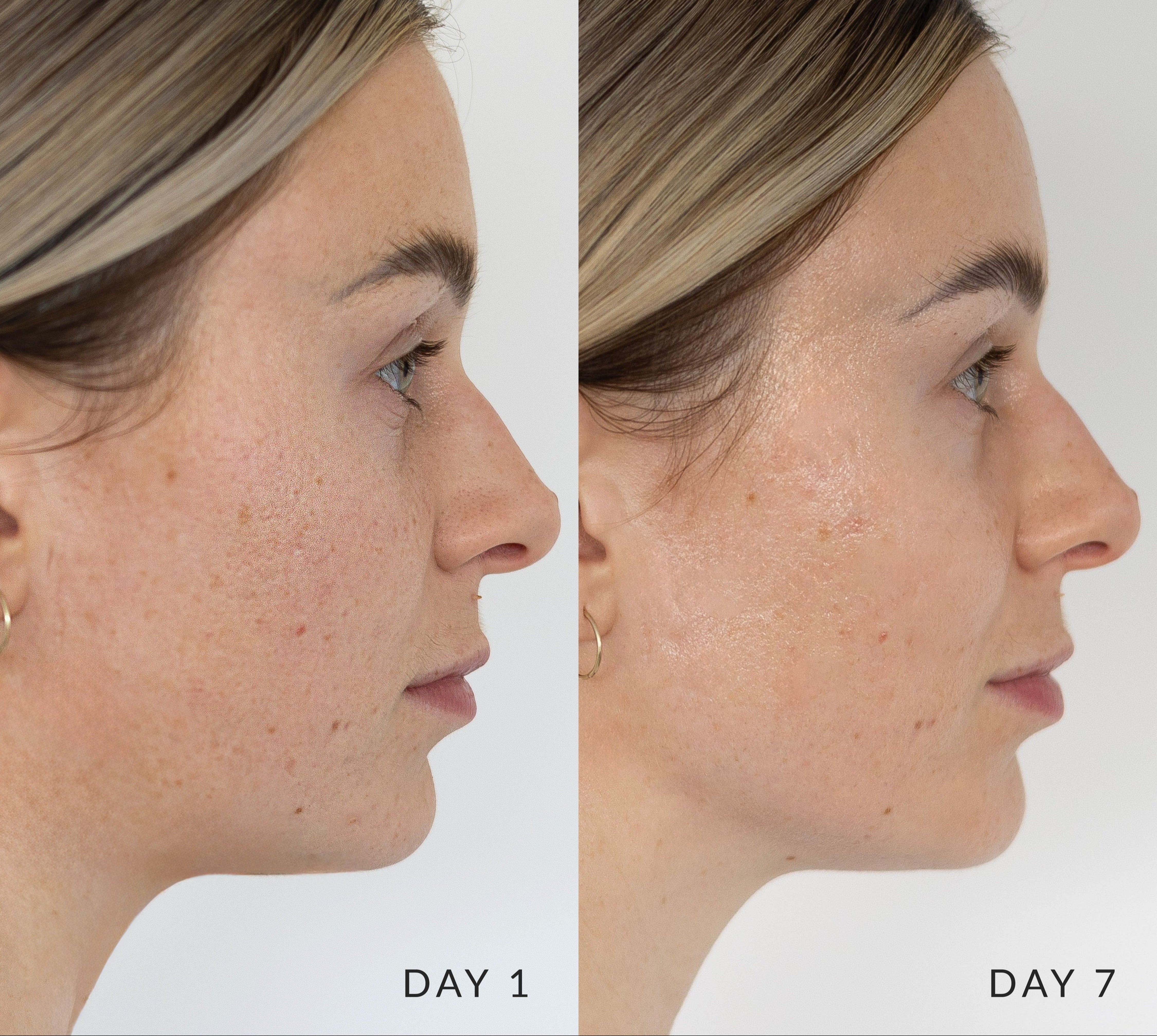 Side-by-side comparison of a woman's face before and after using Glory Cream for 7 days. 
