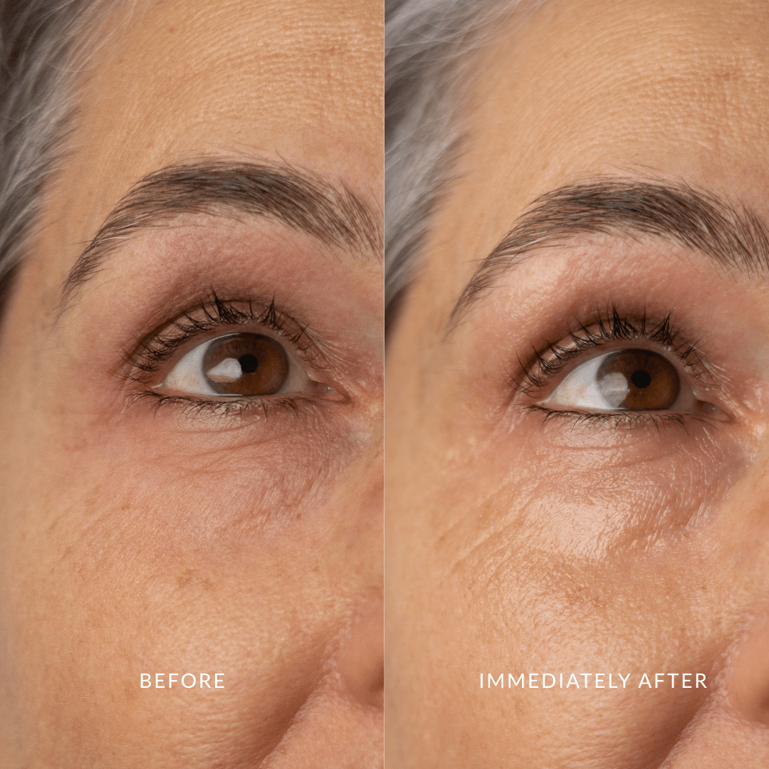 Glory Eyes, best Skin Care from Eco By Sonya Australia