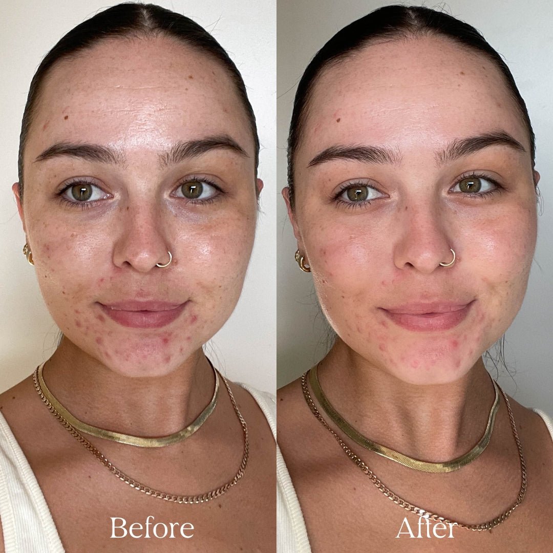 Comparison of before and after using the Face Compost Purple Power Mask