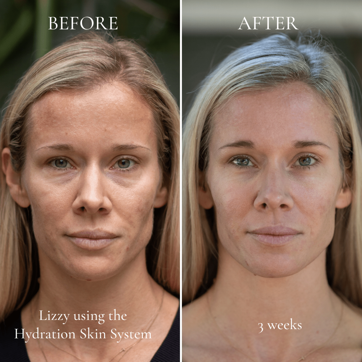 Hydration Skin System - Eco Tan Australia